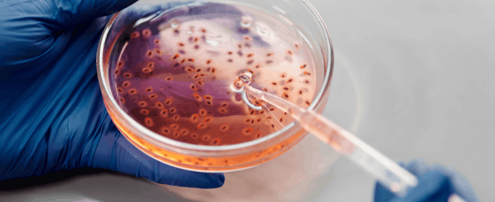 Brain-Eating Amoeba: What Singapore Residents Need to Know