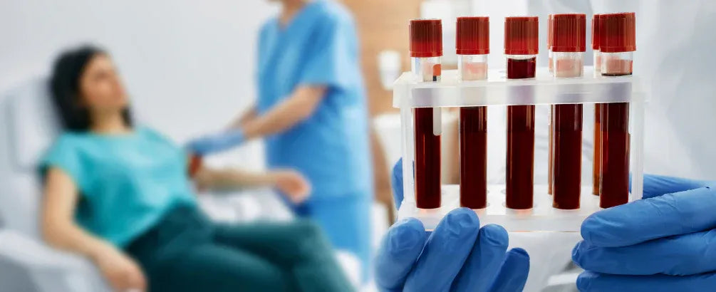 Can I Drink Water Before a Blood Test?